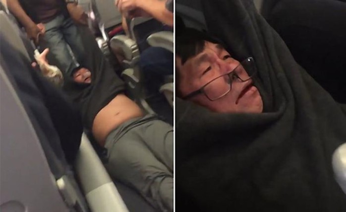 Hành khách bị thương, chảy máu trong quá trình cưỡng chế. Ảnh: New York Daily News.