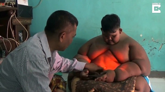 Bé trai 10 tuổi nặng 190kg vì nghiện nước ngọt và mì ăn liền - Ảnh 1.