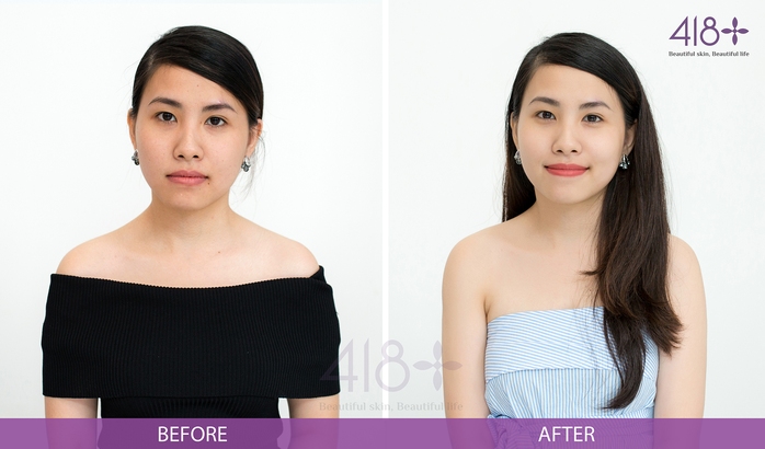 Đa công nghệ - Giải pháp đột phá với triển vọng trẻ hóa làn da - Ảnh 3. Đa công nghệ - Giải pháp đột phá với triển vọng trẻ hóa làn da - Ảnh 3.