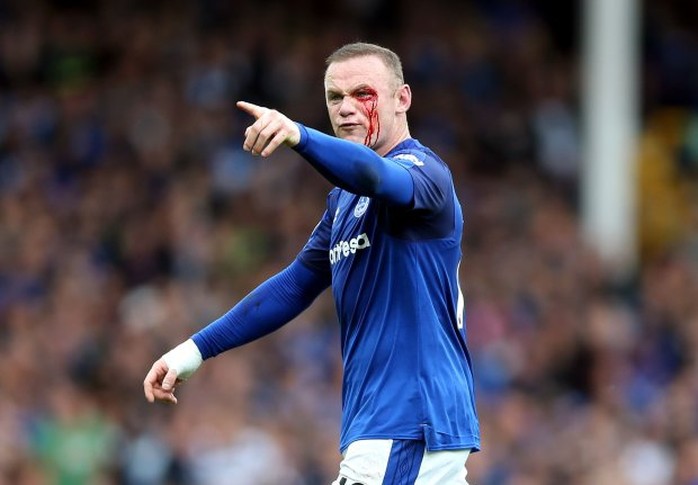 Dính chỏ đối thủ, Rooney mắt bê bết máu - Ảnh 6.