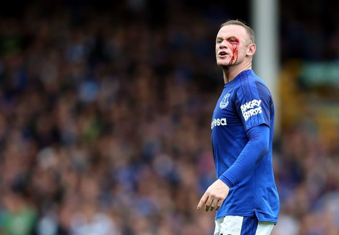 Dính chỏ đối thủ, Rooney mắt bê bết máu - Ảnh 5.