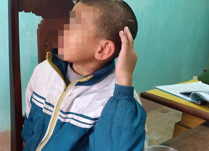 Bé trai 10 tuổi bị sư thầy bạo hành thâm tím khắp người - Ảnh 2.