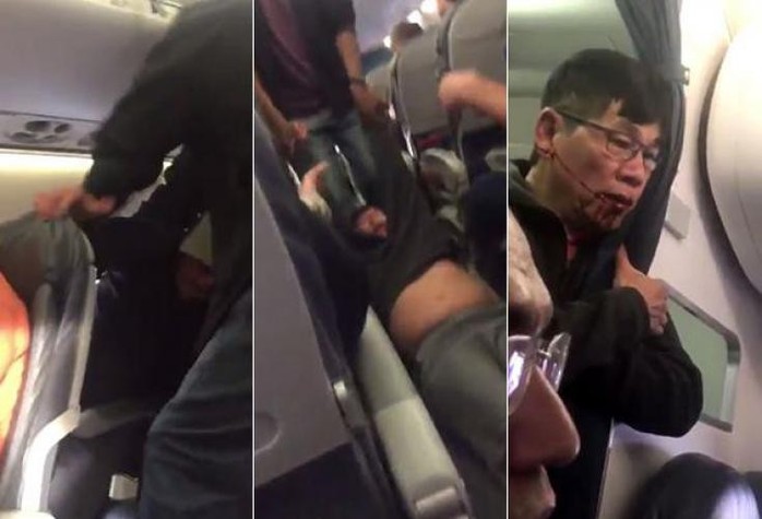 Vụ bác sĩ gốc Việt bị kéo lê: Cựu nhân viên an ninh kiện United Airlines - Ảnh 1.
