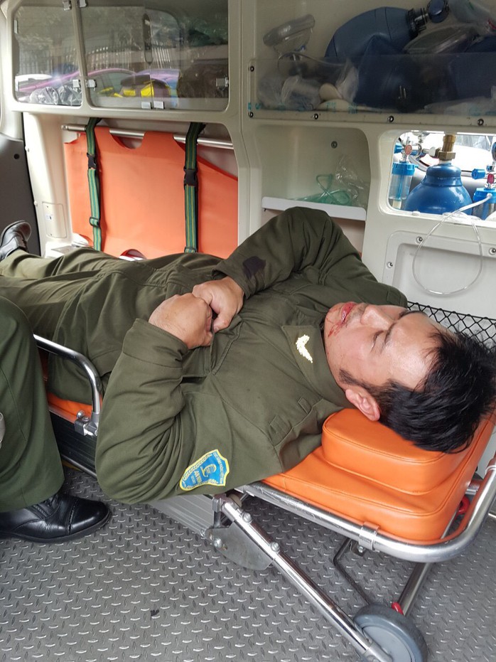 Nhân viên an ninh hàng không Nội Bài bị cò mồi đánh gãy răng - Ảnh 1.