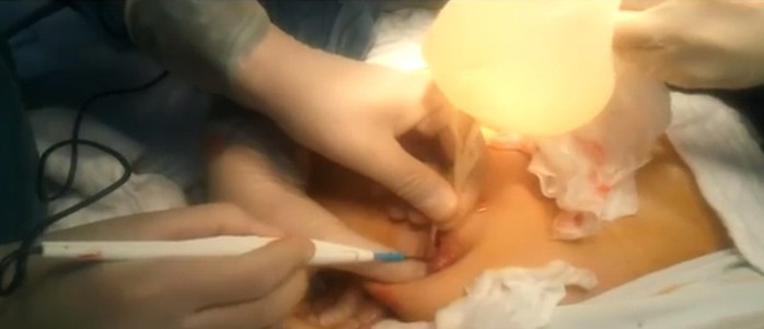 TP HCM: Một nữ Việt kiều tử vong sau khi căng da mặt làm đẹp - Ảnh 1.