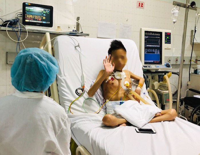 Bệnh nhân bất ngờ được xuất viện sau gần 2 tháng ghép phổi từ người cho chết não - Ảnh 2.