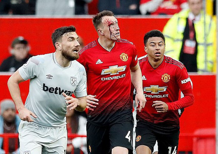 Phil Jones đổ máu, Pogba thăng hoa với cú đúp phạt đền  - Ảnh 7.