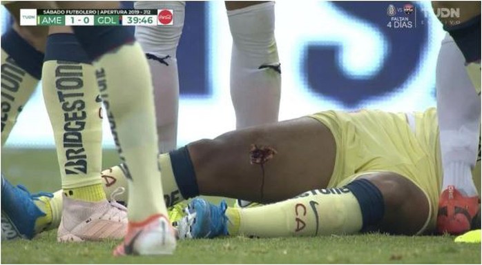 Dính chấn thương ghê rợn, cựu sao Barcelona phải nhập viện cấp cứu - Ảnh 5.