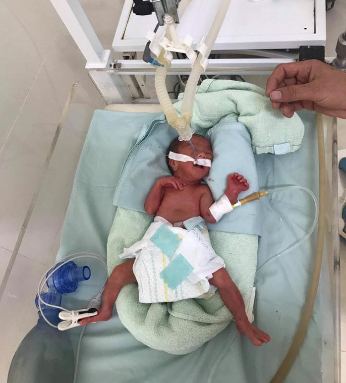 Bác sĩ xúc động kể lại hành trình vượt gần 600 km giành sự sống cho bé sinh non - Ảnh 3.