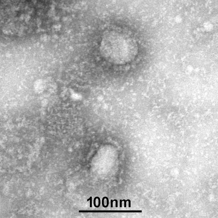 Trung Quốc công bố những hình ảnh đầu tiên của virus Vũ Hán - Ảnh 2.