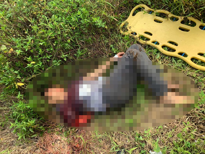 Đà Nẵng: Nam thanh niên bị tàu tông đứt lìa cánh tay - Ảnh 1.