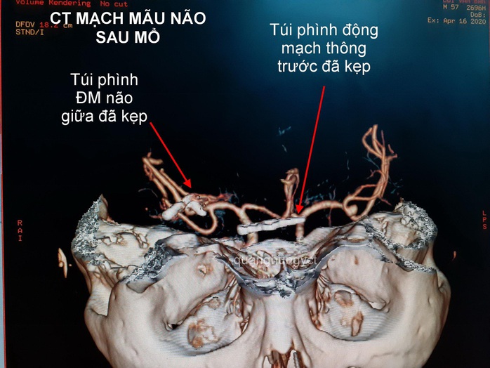 4 giờ căng thẳng giành lấy sự sống cho bệnh nhân tưởng chừng như tử vong - Ảnh 2.