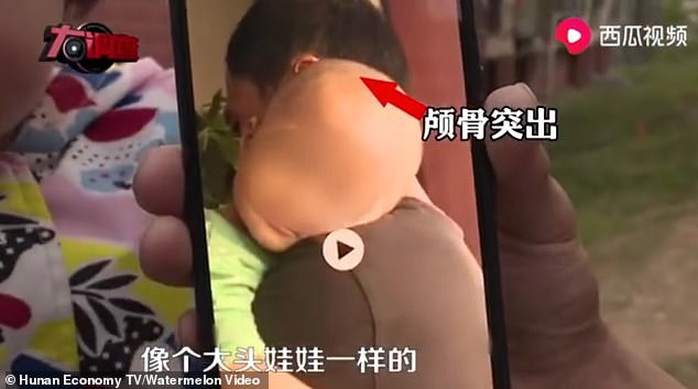 Trung Quốc: Trẻ em bị sưng đầu vì thức uống protein gắn mác sữa công thức? - Ảnh 2.
