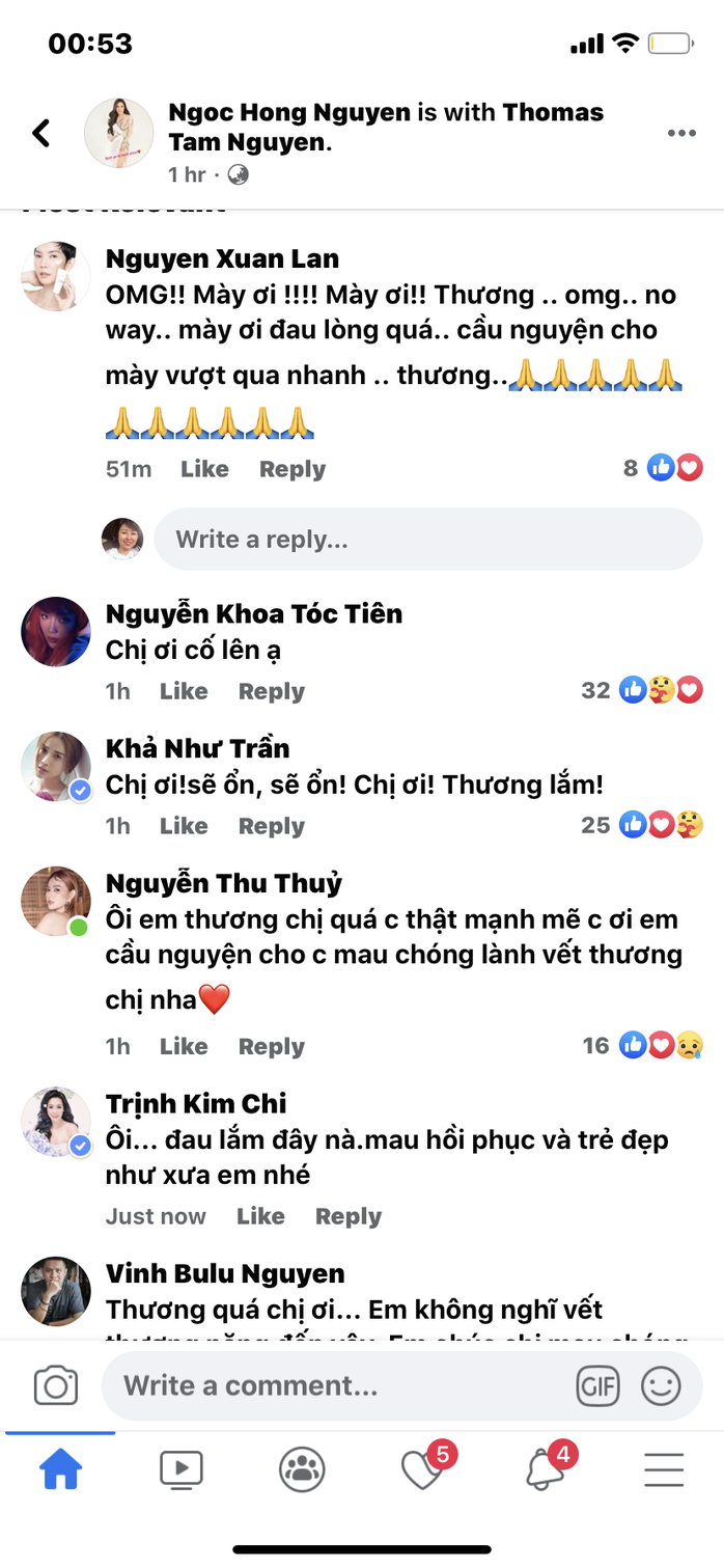 Nghệ sĩ xót xa khi nhìn thấy gương mặt ca sĩ Hồng Ngọc - Ảnh 2.