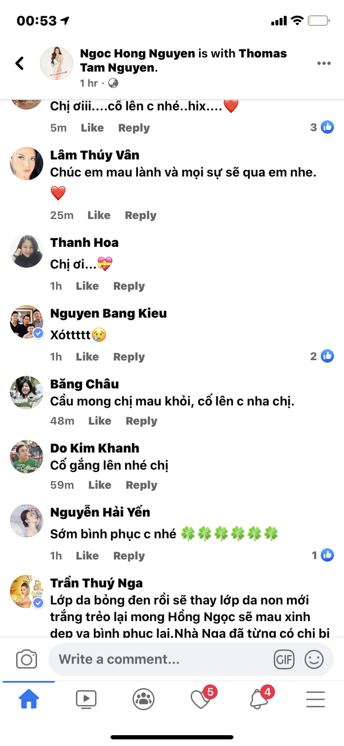 Nghệ sĩ xót xa khi nhìn thấy gương mặt ca sĩ Hồng Ngọc - Ảnh 3.