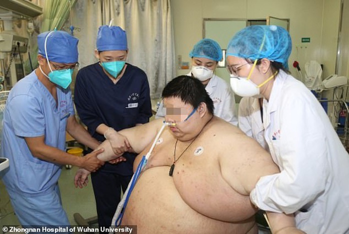 Thanh niên Trung Quốc cấp cứu do tăng 100 kg trong 5 tháng trốn dịch - Ảnh 4.