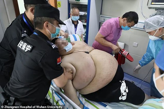 Thanh niên Trung Quốc cấp cứu do tăng 100 kg trong 5 tháng trốn dịch - Ảnh 5.