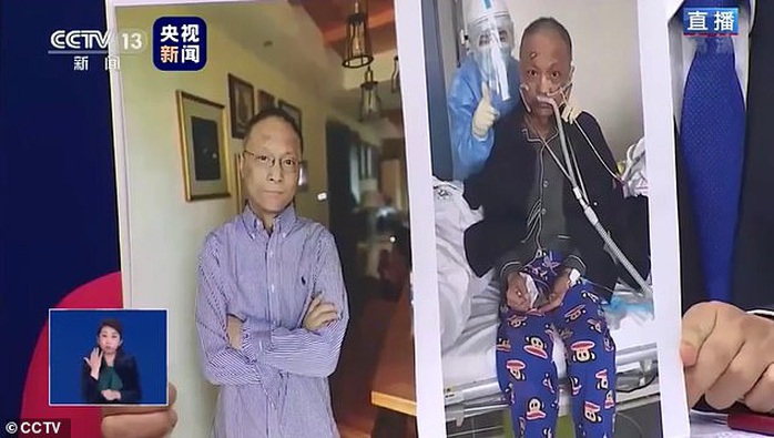 Bác sĩ Trung Quốc bị đổi màu da vì Covid-19 qua đời sau gần 5 tháng điều trị - Ảnh 3.