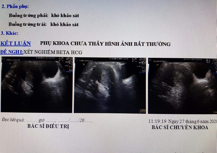 Vụ vác bụng đi đẻ ... nhưng không có thai: Siêu âm không có thai nhưng con vẫn đạp trong bụng? - Ảnh 3.