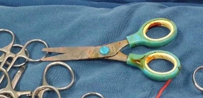 Bé trai 7 tuổi bị kéo đâm xuyên cổ khi cắt giấy làm diều - Ảnh 3.