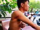 Côn đồ thoát án Côn đồ thoát án