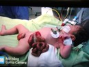Một bé sơ sinh bị ruột nằm ngoài da hiếm gặp Một bé sơ sinh bị ruột nằm ngoài da hiếm gặp