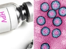 Vắc-xin HPV có vấn đề? Vắc-xin HPV có vấn đề?