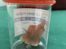 Dự tiệc về nghỉ trưa, nam thanh niên nuốt luôn răng giả Dự tiệc về nghỉ trưa, nam thanh niên nuốt luôn răng giả