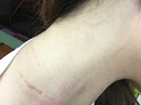 Nữ nhân viên hàng không bị đánh chưa ổn định tâm lý Nữ nhân viên hàng không bị đánh chưa ổn định tâm lý