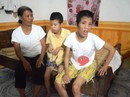 Dai dẳng nỗi đau da cam Dai dẳng nỗi đau da cam