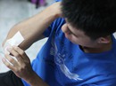 Nhập viện vì... miếng dán Nhập viện vì... miếng dán