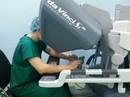 Phẫu thuật ca ung thư dạ dày đầu tiên bằng "người máy" Phẫu thuật ca ung thư dạ dày đầu tiên bằng "người máy"
