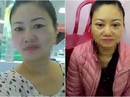 Tai nạn khi làm đẹp đón Tết khiến chị em dở khóc dở cười Tai nạn khi làm đẹp đón Tết khiến chị em dở khóc dở cười