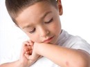 Đừng xem nhẹ vết lõm trên da Đừng xem nhẹ vết lõm trên da