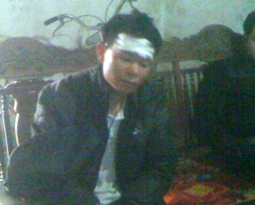 Anh Nguyễn Thanh Sơn bị đánh trong thương ở vùng đầu.