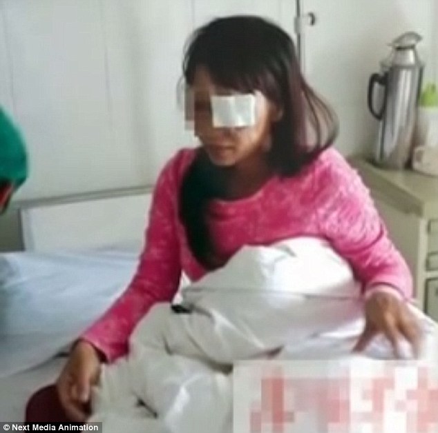 A Chinese woman's eye was gouged out by her husband after he discovered she was in a new relationship and wanted a divorce, it has been reported