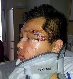 Victim: Minh Duong in hospital after being attacked by neo-Nazis.