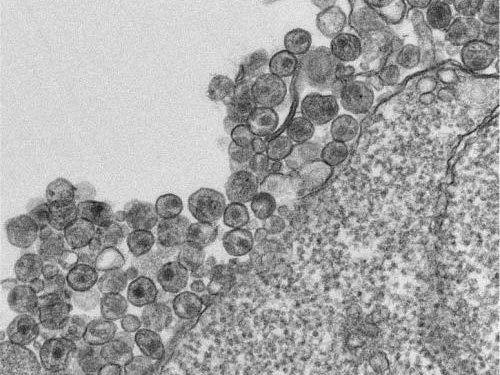 Hình ảnh qua kính hiển vi cho thấy các phần tử HIV-1 tích tụ ngoài tế bào Ảnh: MEDICAL XPRESS