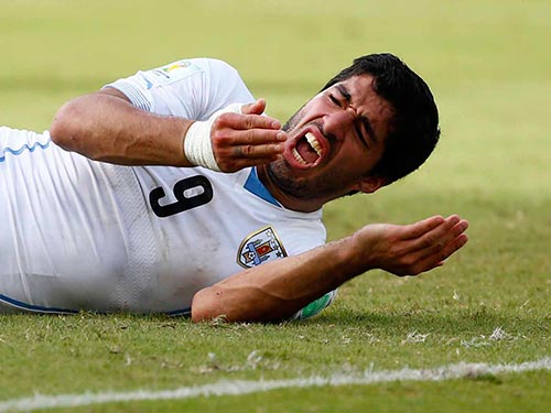 Leg: Suarez đau răng sau pha cắn vai Chiellini Ảnh: REUTERS