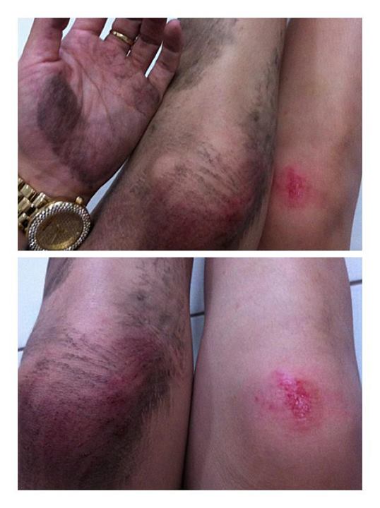 Lại thêm nữ ca sĩ bị cướp giật táo tợn tại TP HCM - Báo Người lao động