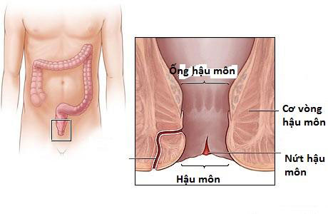 Nứt hậu môn, nguyên nhân thường gặp làm đau hậu môn Nứt hậu môn, nguyên nhân thường gặp làm đau hậu môn