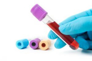 Bệnh nhân ung thư tuyến tiền liệt nhóm máu O ít có nguy cơ tái phát 35% so với bệnh nhân nhóm máu A Ảnh: MNT