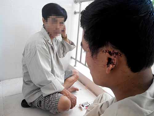Một công nhân bị một nhóm lao động quê Phú Yên cắt tai để giải quyết mâu thuẫn