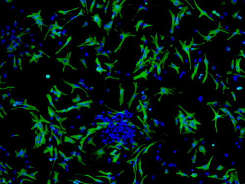 Tế bào hình sao astrocyte ở não chuột
Ảnh: Science Cell
