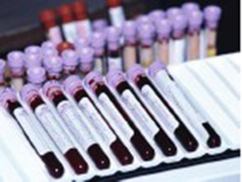 Dấu chỉ về gien trong máu xác định bệnh Parkinson chính xác đến 90% Ảnh: HEALTHDAY NEWS