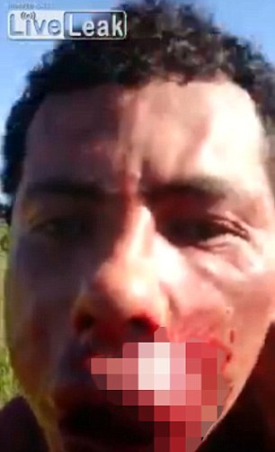 Thanh niên bị đánh bị thương nặng ở mặt. Ảnh: Live Leak
