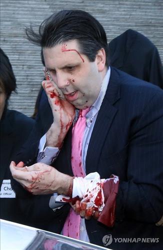 Đại sứ Mỹ Lippert bị tổng cộng 5 vết chém, nặng nhất là vết trên mặt. Ảnh: Yonhap