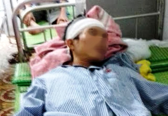 
Anh Trịnh Xuân Mạnh bị đánh vỡ đầu đang điều trị tạ Bệnh viện Đa khoa huyện Hà Trung - Thanh Hóa
