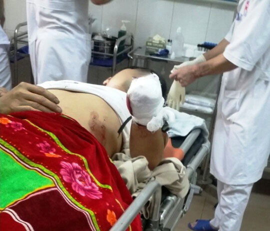 
Anh Lê Văn Ng. khi được đưa tới bệnh viện cấp cứu với bàn tay trái bị chặt đứt - Ảnh: Nghi Lộc
