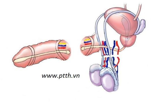 Mua Dao lượn sóng cán dài cắt củ quả chè khúc bạch  Dụng cụ cắt tạo hình  chuyên dụng cho bé ăn dặm BWL NB06  Tiki